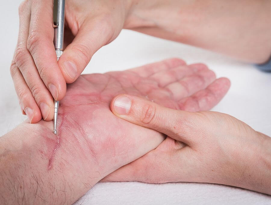 Akupunkt-Massage und Narbenbehandlung - Fitness & Wohlfhlen Issum